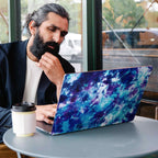 Laptop Skins & Wraps in India by WrapCart. Best quality 3M laptop stickers and wraps with perfect cutting