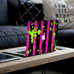 neon-patterns-laptop-skin-macbook